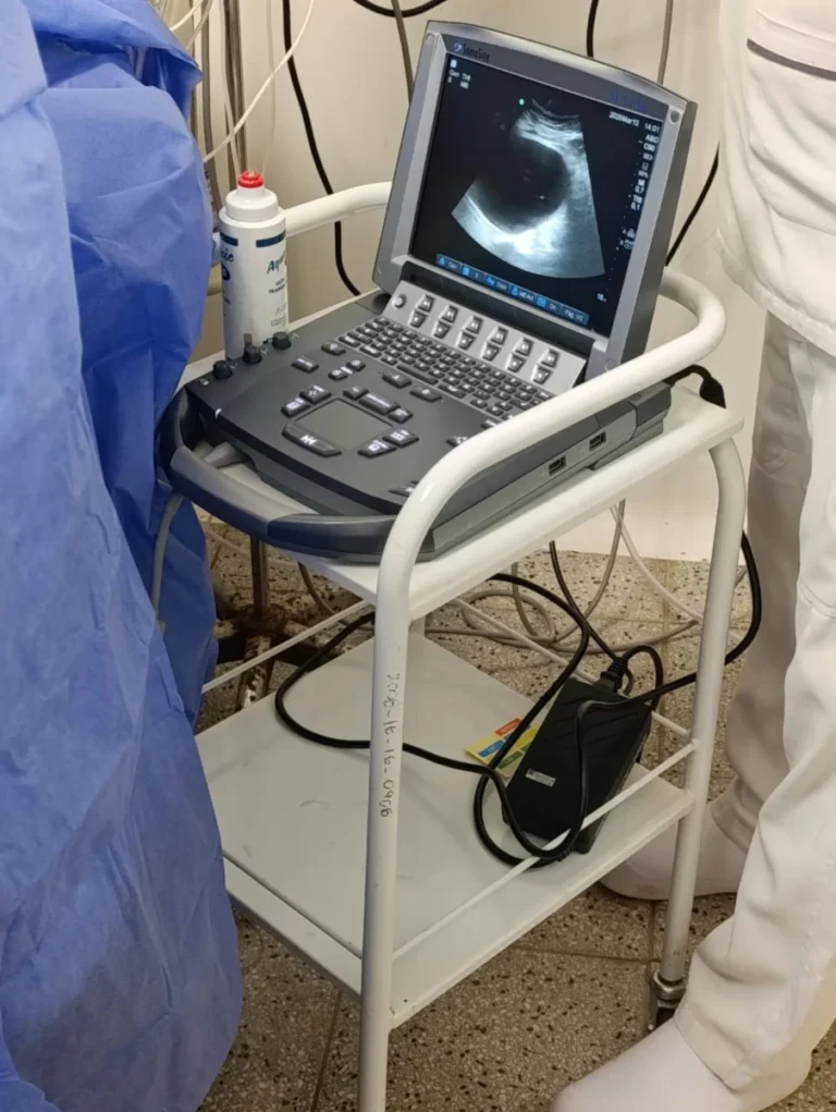 Salud: Primer drenaje percutáneo del páncreas en el Hospital Regional