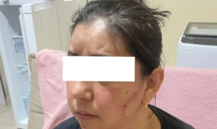 Madre denuncia agresión sufrida por su hija a manos de familiares de su esposo