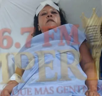 Ciudadana paraguaya escapó de brutal agresión de su pareja en Ponta Porã; la mujer fue internada en el Hospital Regional local
