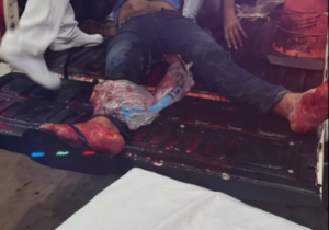 Vidrio roto causa la muerte de un hombre en el barrio General Genes